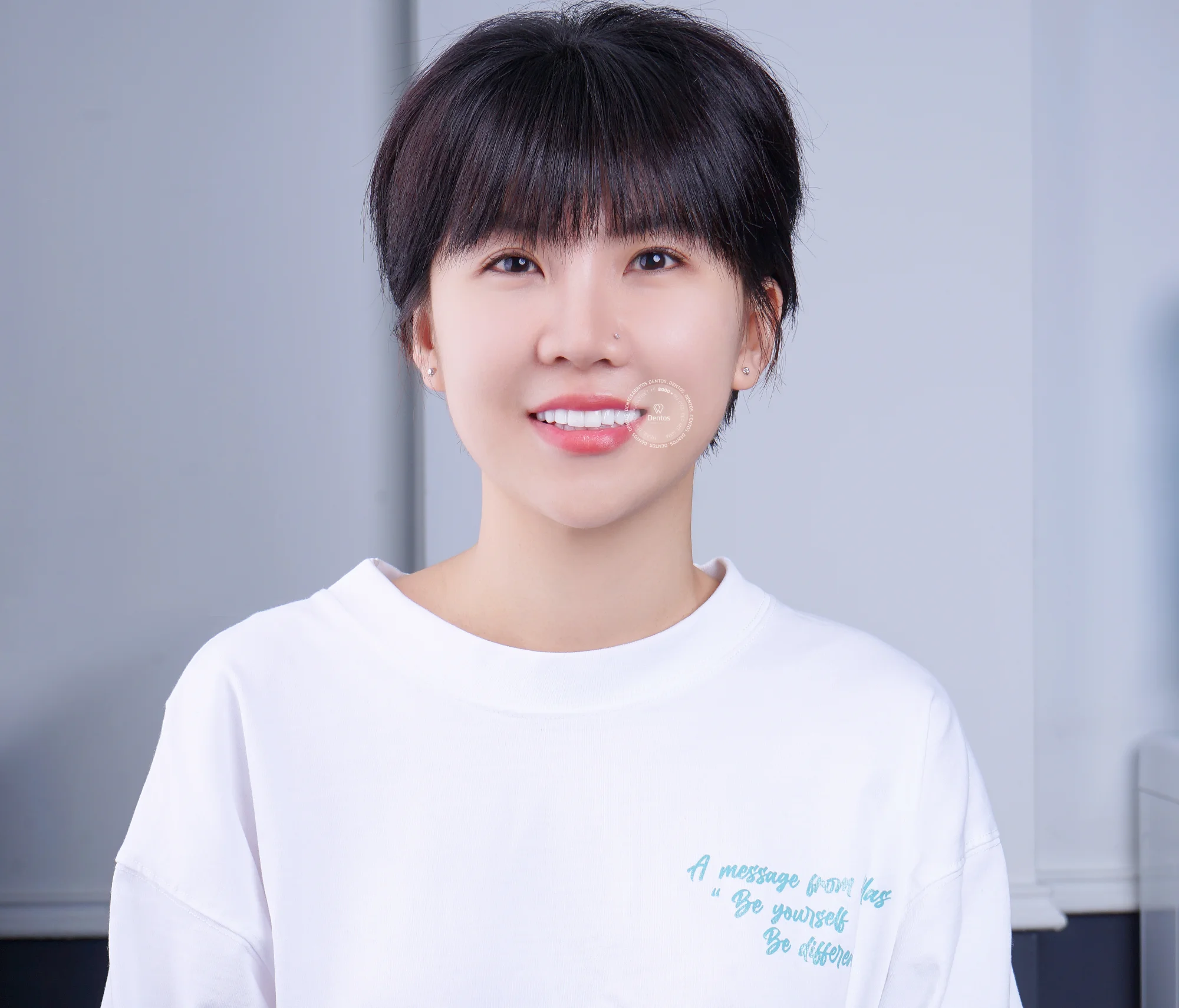 Dán răng sứ veneer và bọc răng sứ khác nhau thế nào?